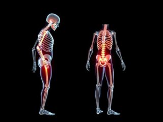 Как укрепить кости и снизить риск переломов: практическая работа над профилактикой остеопороза